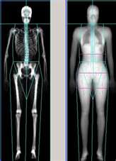 What is a DEXA Scan?  Lake Medical Imaging - The Villages, Florida