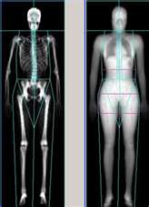 Get screened for osteoporosis using DEXA scans