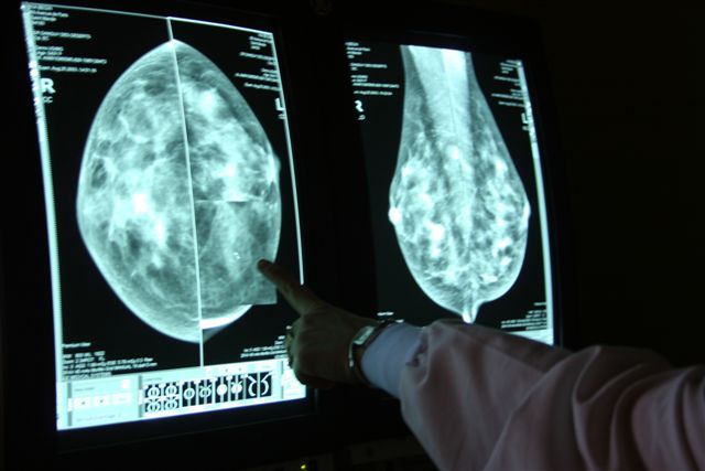 Womens Mammography